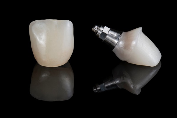 Complete Your Smile With An Implant Crown